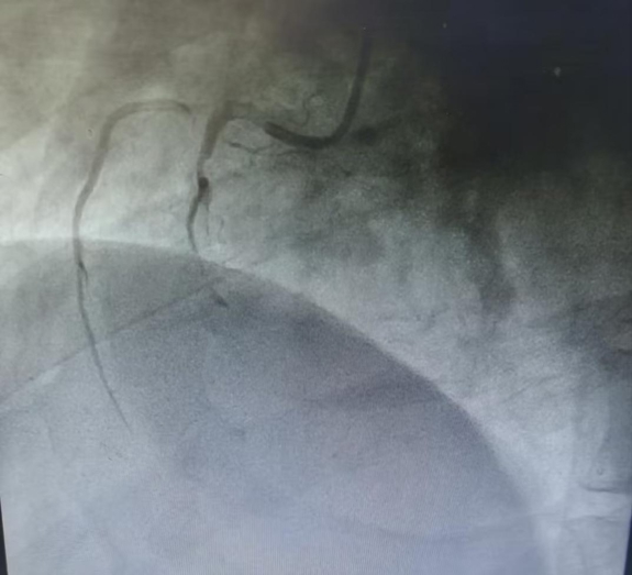 生死竞速护“心”脉—— 衡阳县中医医院心内科获群众“12345”热线实名表扬